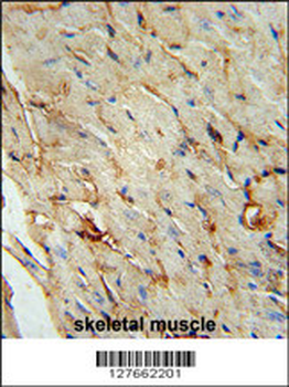 SCAR5 Antibody (C-term)