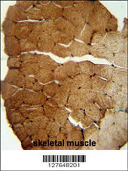 S35B2 Antibody (C-term)