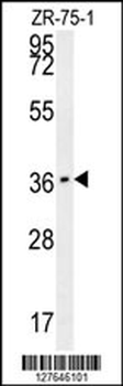CLEC12A Antibody (Center)