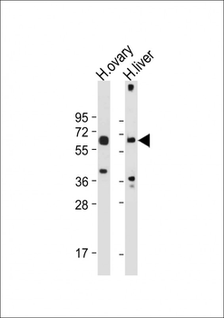 POTEB Antibody (C-term)