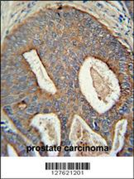 POTEB Antibody (C-term)