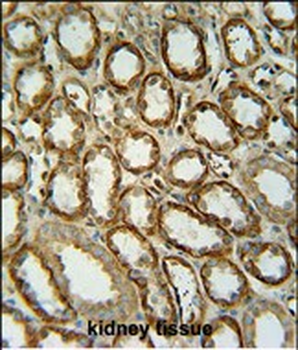 SLC7A13 Antibody (Center)