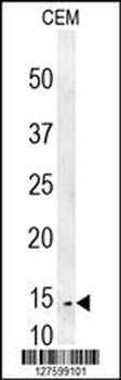 CRCT1 Antibody (N-term)