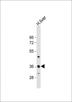 C6orf58 Antibody (Center)