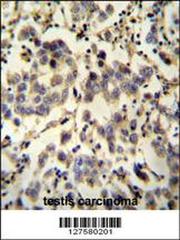 C6orf58 Antibody (Center)