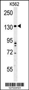 TMEM132D Antibody (C-term)
