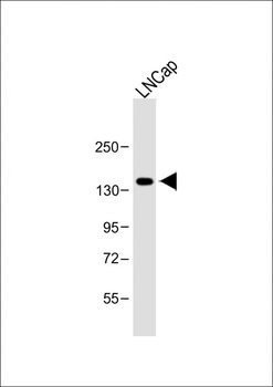 POTEE Antibody (Center)