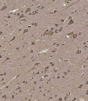 MET10 Antibody (C-term)
