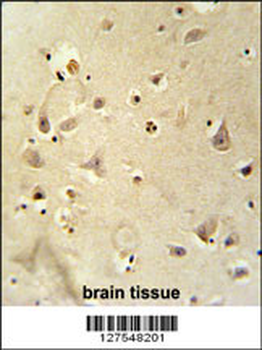 RSRC1 Antibody (Center)