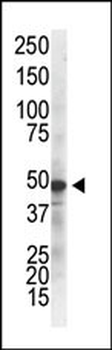 IKK gamma Antibody
