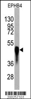 EPHB4 Antibody