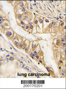 EPHB2 Antibody