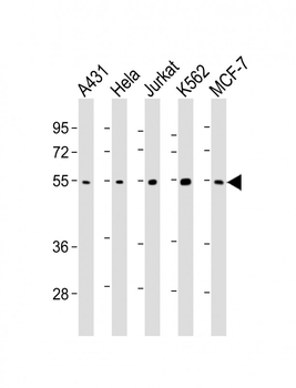 CHK1 Antibody