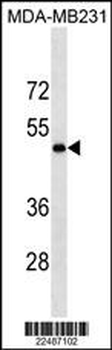 LOX Antibody (Center)