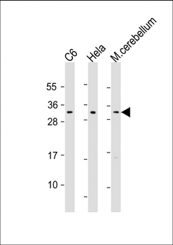 PIp1 Antibody (Center)