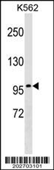 ITGB2 Antibody