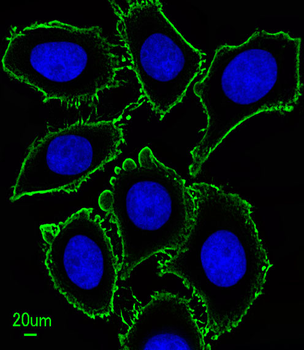 KIT Antibody
