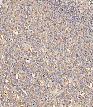 KIT Antibody