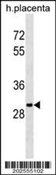 OR5B12 Antibody (C-term)
