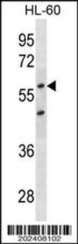 CDKN1C Antibody