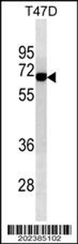ALB Antibody