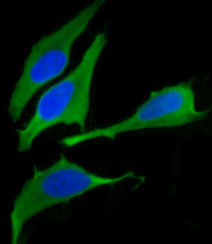 FASN Antibody (Center)