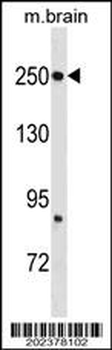 FASN Antibody (Center)