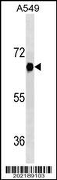 DYRK2 Antibody