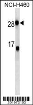CRP Antibody