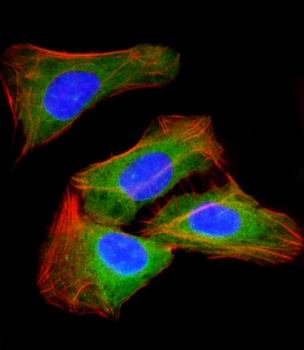 RAB23 Antibody