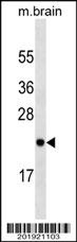 RAB23 Antibody