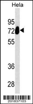 ALPP Antibody (N-term)