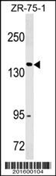 ITGAX/CD11c Antibody (N-term)