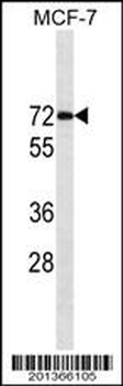 ESR1/ER Antibody