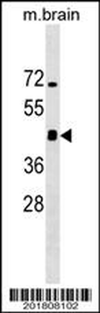 Mouse Irgm1 Antibody (C-term)