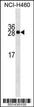 APCS Antibody