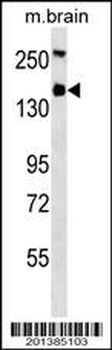 TSC1 Antibody