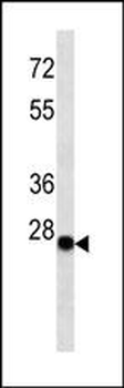 Kappa light chain Antibody