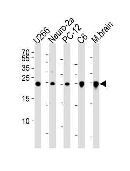 UCHL1 Antibody