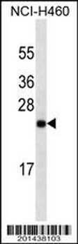UCHL1 Antibody