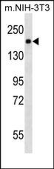 PDGFR Antibody