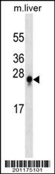 S100B Antibody