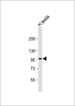 HIPK4 Antibody