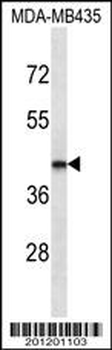 LHX2 Antibody