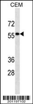 DESM Antibody