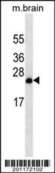 RAB8A Antibody