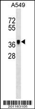 METAP1 Antibody