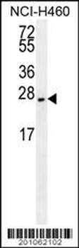 EIF4E2 Antibody
