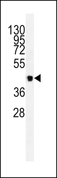 VEGFC Antibody