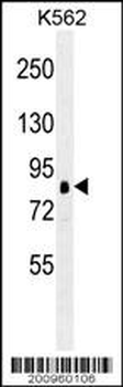 RPS6KA1 Antibody